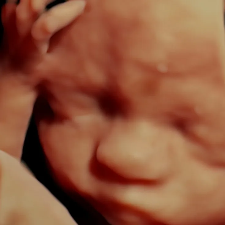 3D-echo in close-up van het gezichtje van een ongeboren baby met een handje bij het hoofd